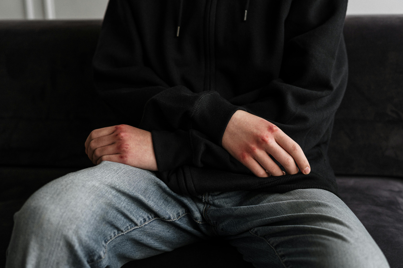 Harm Reduction